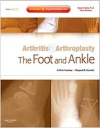 Arthritis & Arthroplasty The Foot and Ankle