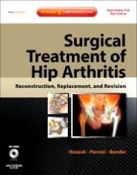 Surgical Treatment of Hip arthritis : Reconstruction, Replacement, and Revision