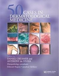 50 Cases In Dermatological Medicine